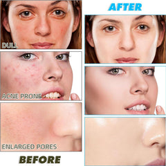 Aacnre turmeric facial cleansing pads — convenient daily preps for clean skin.