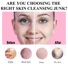 Aaenouicfs Eggplant mud mask unclogs pores for clearer skin
