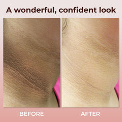 Applying ABERA neck cream to neck skin for even tone and texture