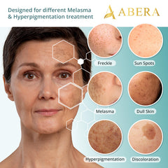 ABERA Melasma Serum Plus packaging box emphasizes premium ingredients and simple skincare routines.