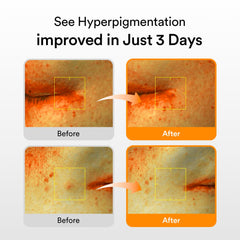 Abib Glutathiosome serum dropper closeup emphasizing fast absorbing texture