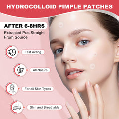AcneGo patches come in 8mm and 12mm sizes for different spots.