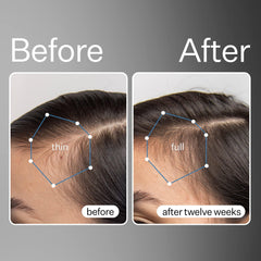 ACT+ACRE serum applied to scalp showing easy daily use and coverage.