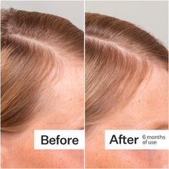 ACT+ ACRE serum texture during application for easy daily use.