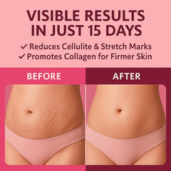 Applying ADEUS Pink Rose Cream to legs for firmer, hydrated skin