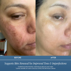 Admire My Skin Potent Retinoid Cream pump bottle enabling easy nightly dosing.