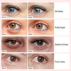Adofect under-eye patches blue pack presented for possible wrinkle and puffiness support.