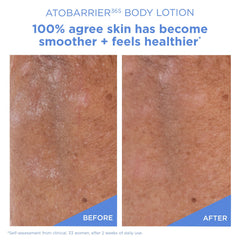 AESTURA ATOBARRIER365 long-lasting hydration on dry skin detail.