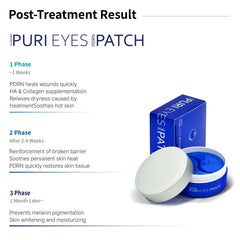 AETERDERM Puri Eyes PDRN Patch being applied under the eyes for rejuvenation
