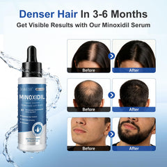 AGIKENB soin barbe minoxidil – Stimule la croissance des poils et définit les contours.