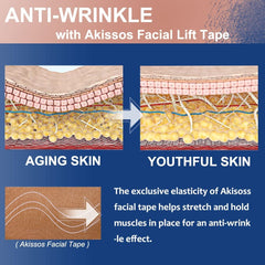 Akissos nasolabial folds area shows gentle support for smile lines.