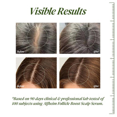 ALFHEIM serum applicator delivers precise root treatment for mess-free application.