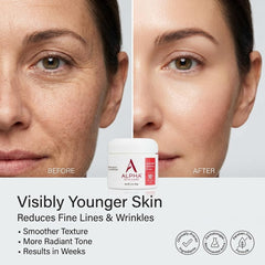 Alpha Skin Care Essential Renewal Cream packshot highlighting lightweight daily care