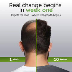 Alphainfuse Panax ginseng and Eclipta Prostrata extracts seen for healthier-looking scalp.