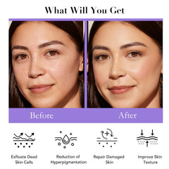 AM AROMANTRA Daily Set Serum dropper highlighting brightening formula.