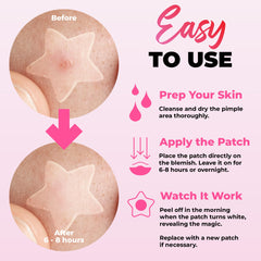 Andlane heart patches offer gentle blemish care with a cute touch for daytime wear.