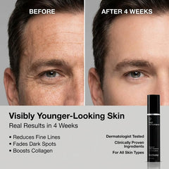 Anthony High Performance Vitamin A Treatment application on cheek illustrating smooth, hydrated skin