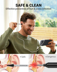 Anykit otoscope 3.9mm camera probe for detailed ear canal visuals.