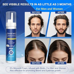 AOOLCF Biotin-infused formula highlights nourishing care for women's hair.