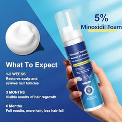 AOOLCF Minoxidil Foam dispenser demonstrates easy scalp application.
