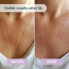 APRICOT ectoin-infused chest pad protecting skin from environmental stress