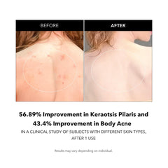 APRILSKIN Carrotene IPMP exfoliating body wash exfoliation action smooths surface texture over time.