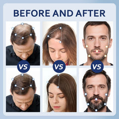 Application cuir chevelu Artimore Minoxidil, manipulation simple et contrôle précis