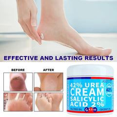 ASDToTio Urea Cream 42% on heels softening rough patches