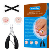 Asinkiher X-Type corrector lifts toenail edges gently for alignment