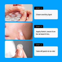 AVARELLE zit patch with Cica promotes soothing skin comfort on affected areas