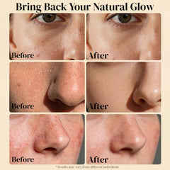 AveCera balm used under the eyes for gentle nourishment