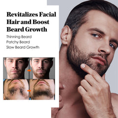 AVITAPURE Minoxidil beard oil dropper allows precise, comfortable dosing.
