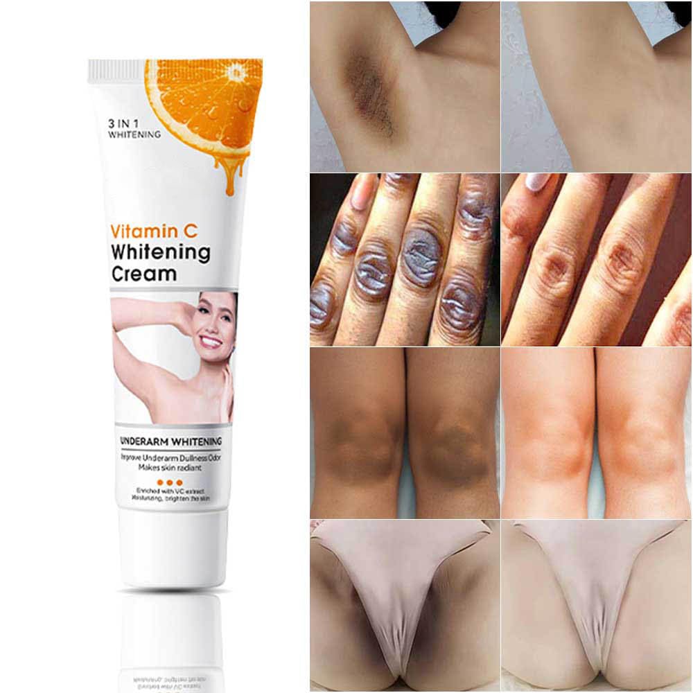 Axnoocy VVhitening Cream packaging with vitamin C benefits for skincare