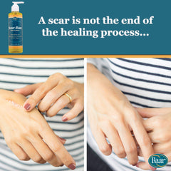 Baar Scar Ban label closeup showcases premium emollients for nourishing the skin.