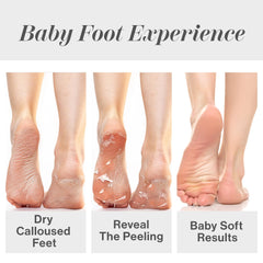 Baby Foot Original at-home spa-like setup invites convenient DIY foot pampering.