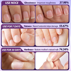 BaiKupo ceramic-tip remover enables precise, gentle cuticle care.