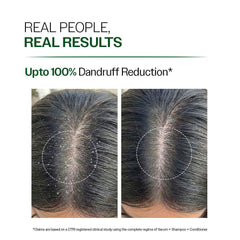 Bare Anatomy anti-dandruff shampoo being poured into hand for routine