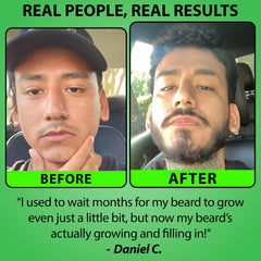 BBS Best Beard Stuff easy daily application helps patchy areas look fuller