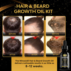 Beaueli Minoxidil women's hair growth serum demonstrating thinning hair support