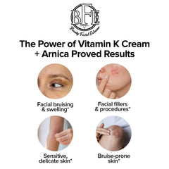 Beauty Facial Extreme Vitamin K Cream spider veins image highlights reduced visibility.