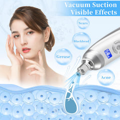 Beauty Star face-nose-forehead-chest-neck use improves surface texture at home.