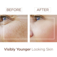 Bee & You propolis extract close-up illustrating soothing, blemish-conscious care