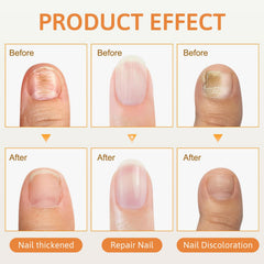 Bee Venom Nail Spray being applied to nails; easy absorption