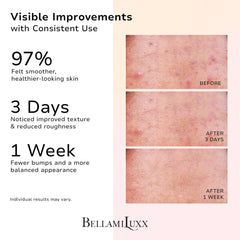 BellamiLuxx butt acne soap bar packaging suggesting a clean daily routine