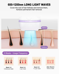 BETNEP IPL device handheld use for portable personal grooming.