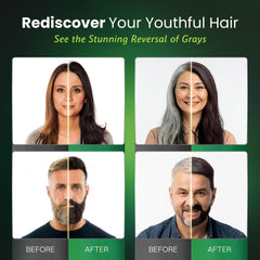 BIOGREEN ROOTS polygonum multiflorum herbs support balanced shade depth.
