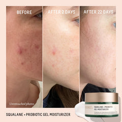 Biossance Squalane + Probiotic Gel Moisturizer texture close-up with lightweight feel.