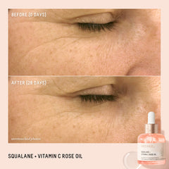 BIOSSANCE Squalane + Vitamin C Rose Oil dropper for even application.
