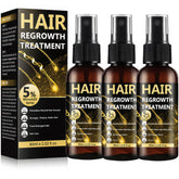 BLISSMATE 5 percent Minoxidil spray bottle ready for daily scalp use to support fuller look