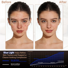 BLISSMON eye-protection feature demonstrates shielded eye area for comfortable use